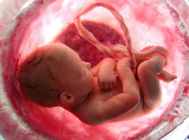 Abortion Was the Leading Cause of Death Worldwide in 2018, Killing 42 Million People